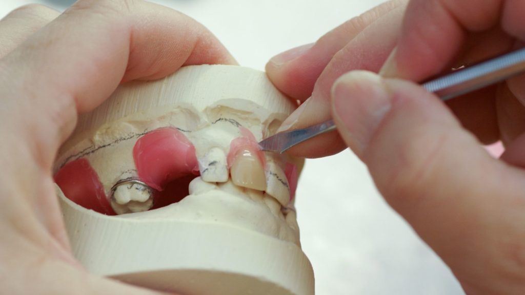 Channel Islands Family Dental Office – Port Hueneme, Ventura Ca 93041