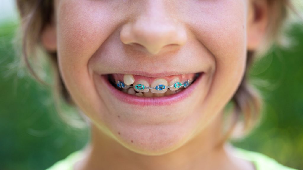 Channel Islands Family Dental Office – Port Hueneme, Ventura Ca 93041