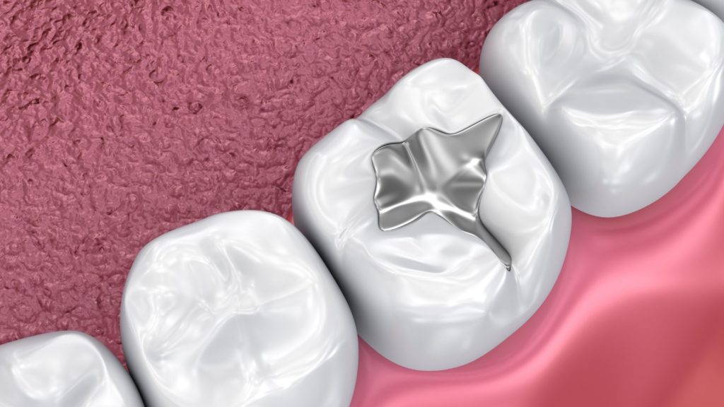 Channel Islands Family Dental Office – Port Hueneme, Ventura Ca 93041