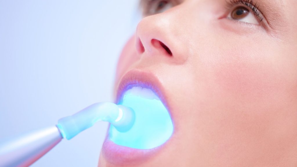 Channel Islands Family Dental Office – Port Hueneme, Ventura Ca 93041