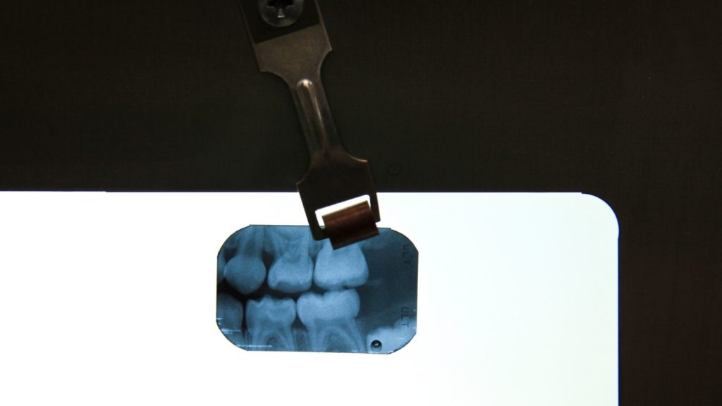 intraoral dental imaging