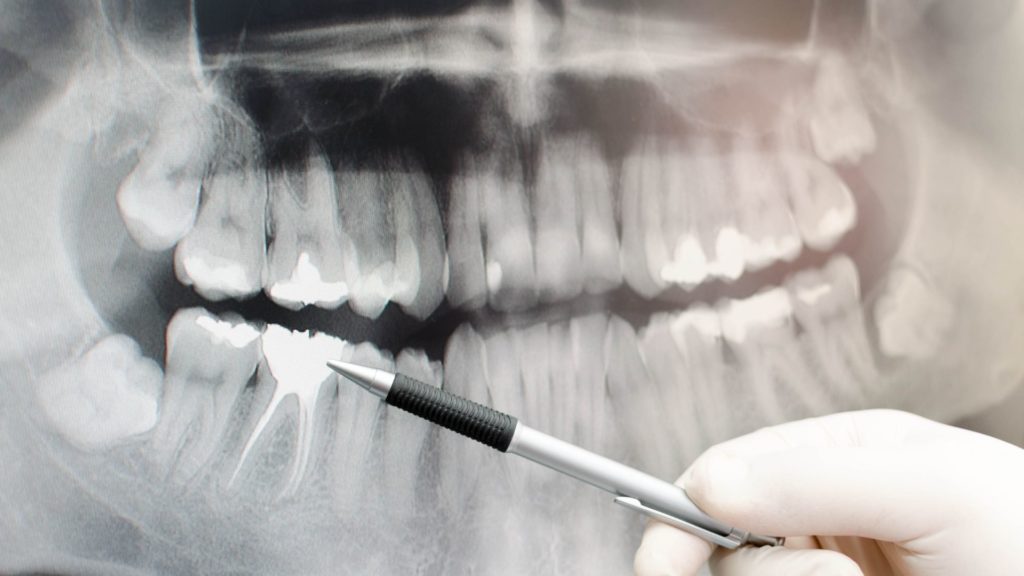 intraoral dental imaging