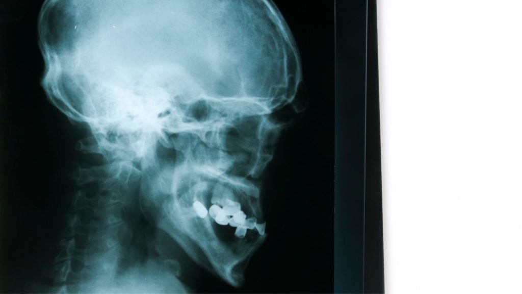 intraoral dental imaging