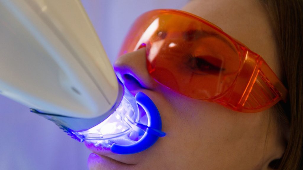 laser teeth whitening with zoom