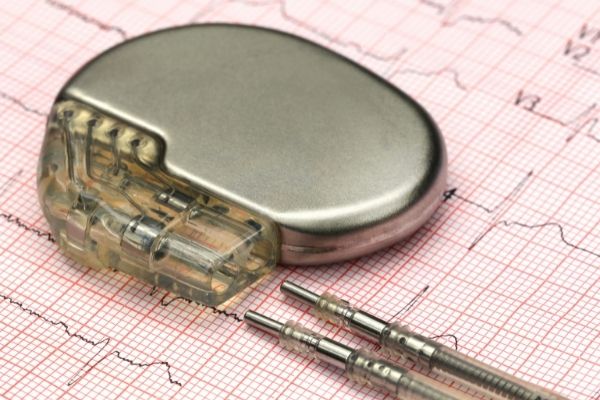 Pacemakers & Dental Visits