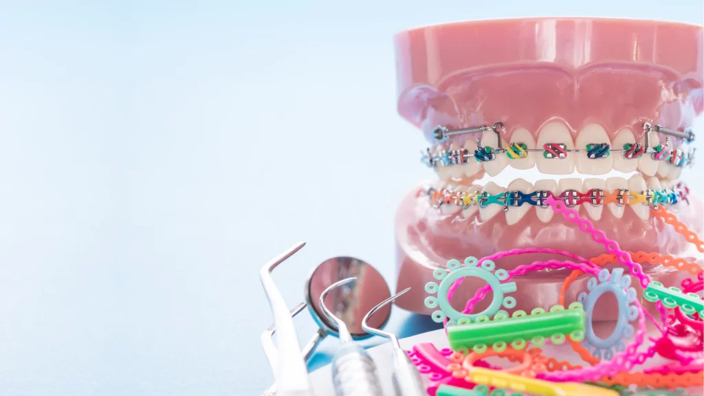 Channel Islands Family Dental Office – Port Hueneme, Ventura Ca 93041