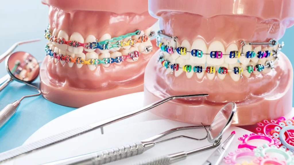 Channel Islands Family Dental Office – Port Hueneme, Ventura Ca 93041