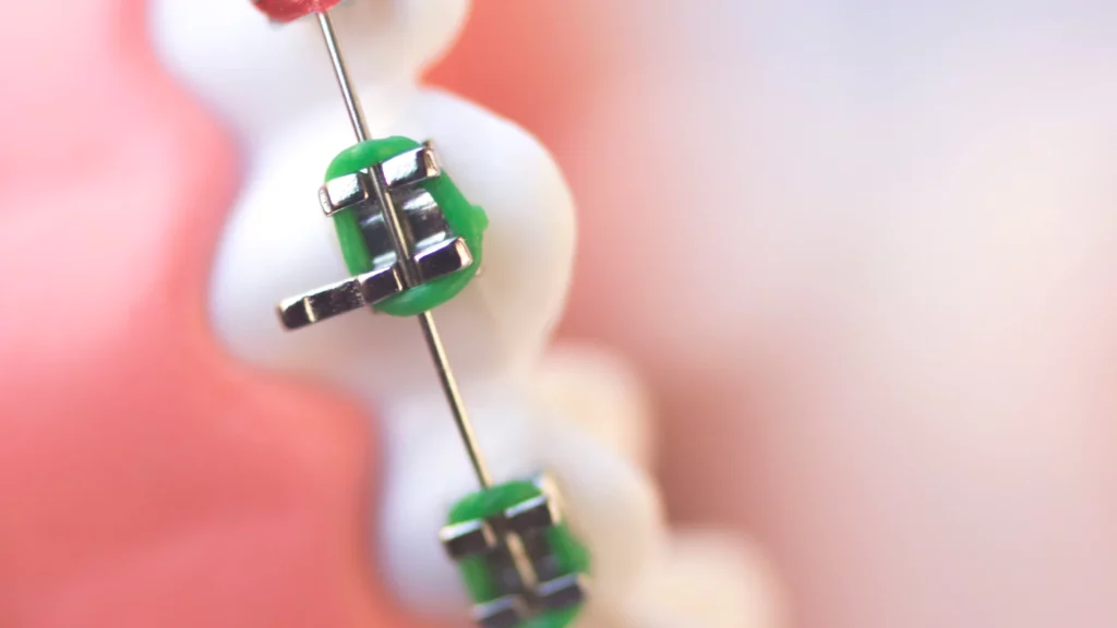 Channel Islands Family Dental Office – Port Hueneme, Ventura Ca 93041