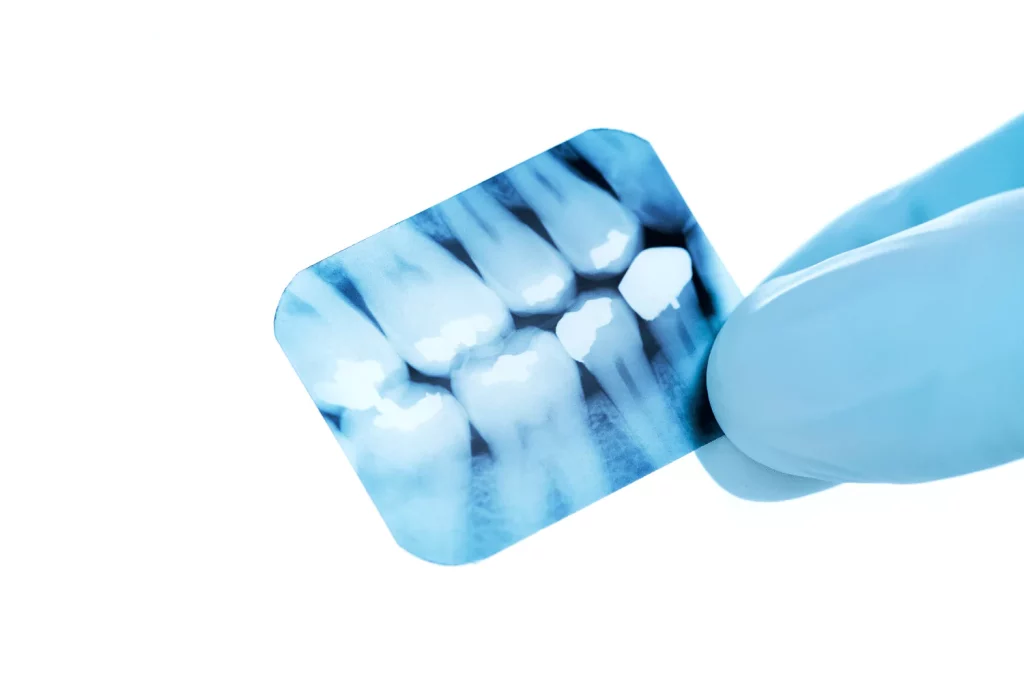 Channel Islands Family Dental Office – Port Hueneme, Ventura Ca 93041