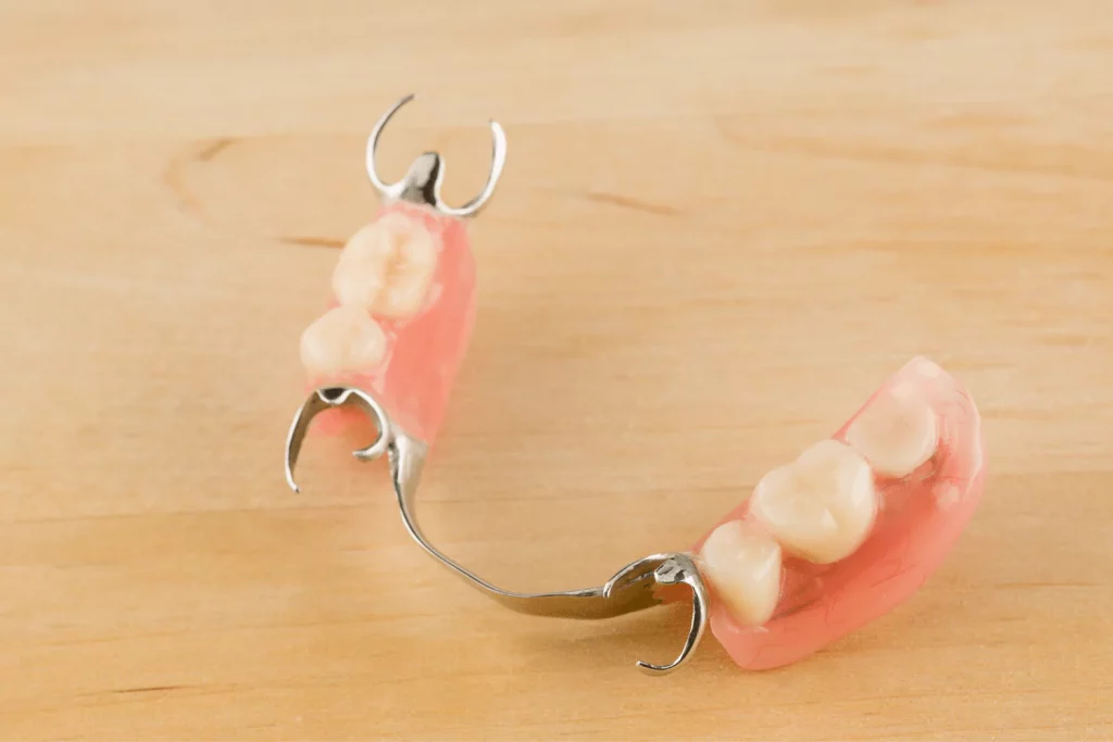 Channel Islands Family Dental Office – Port Hueneme, Ventura Ca 93041