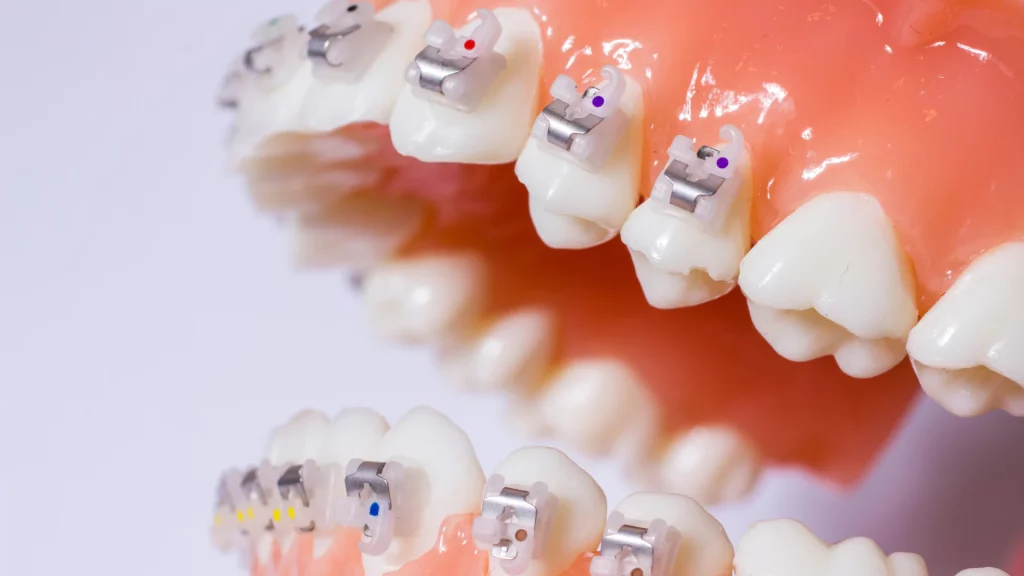 Channel Islands Family Dental Office – Port Hueneme, Ventura Ca 93041