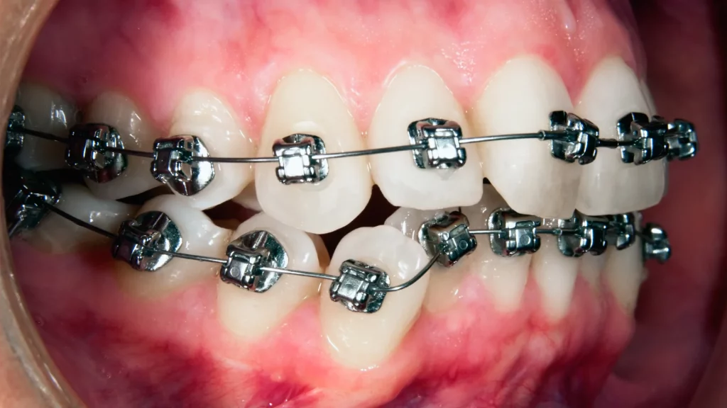 Channel Islands Family Dental Office – Port Hueneme, Ventura Ca 93041