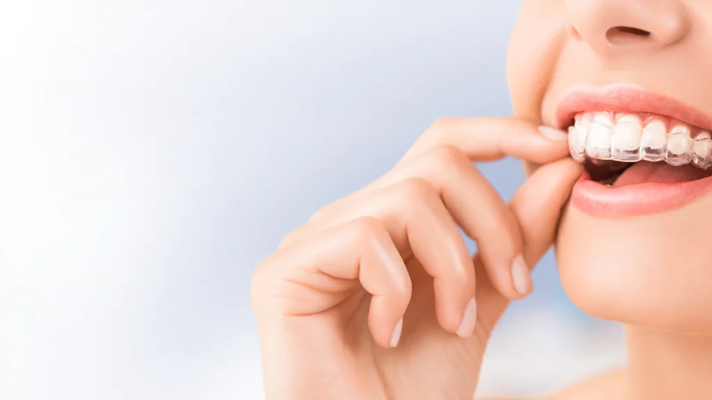 Channel Islands Family Dental Office – Port Hueneme, Ventura Ca 93041