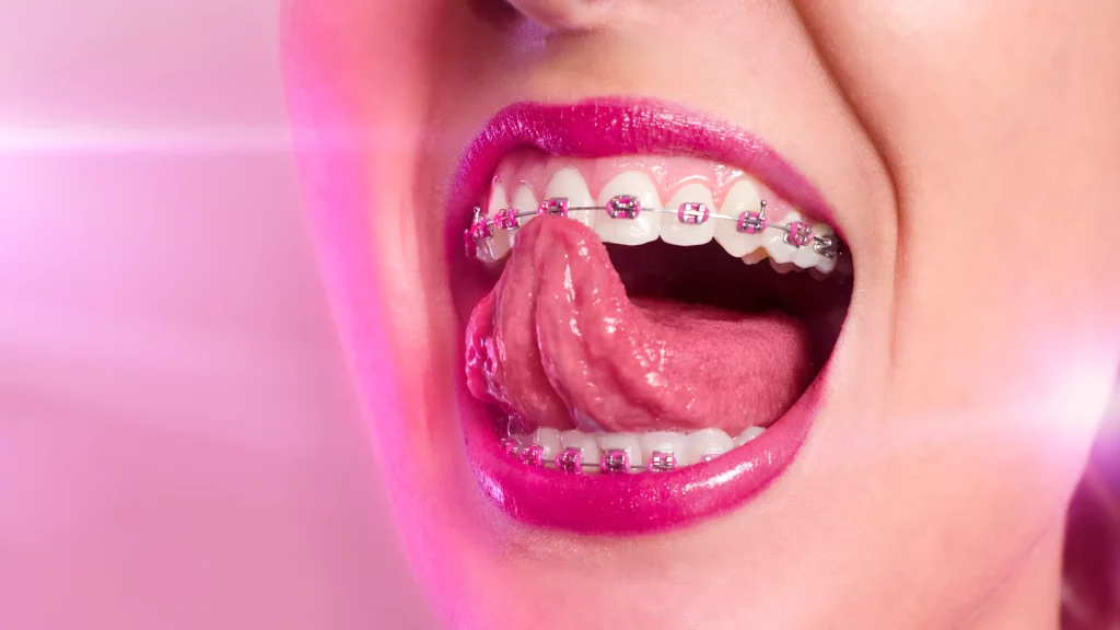 Channel Islands Family Dental Office – Port Hueneme, Ventura Ca 93041