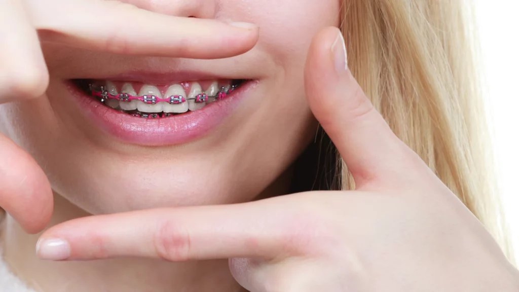 Channel Islands Family Dental Office – Port Hueneme, Ventura Ca 93041