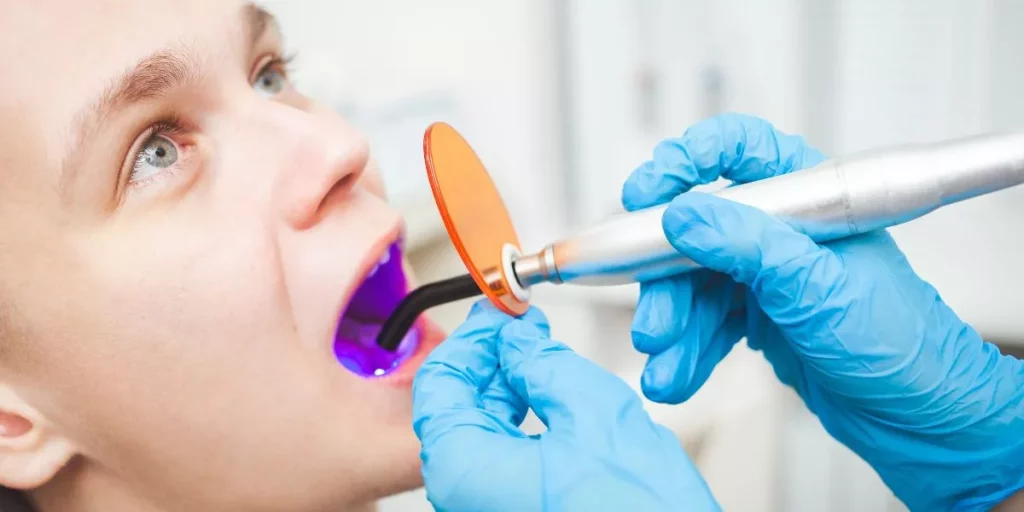 Limpieza Dental Asequible en Port Hueneme