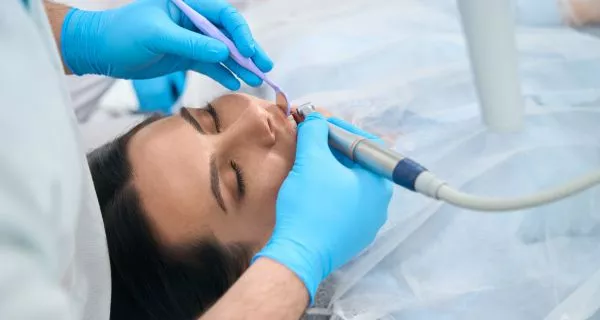 What Is a Professional Dental Cleaning?