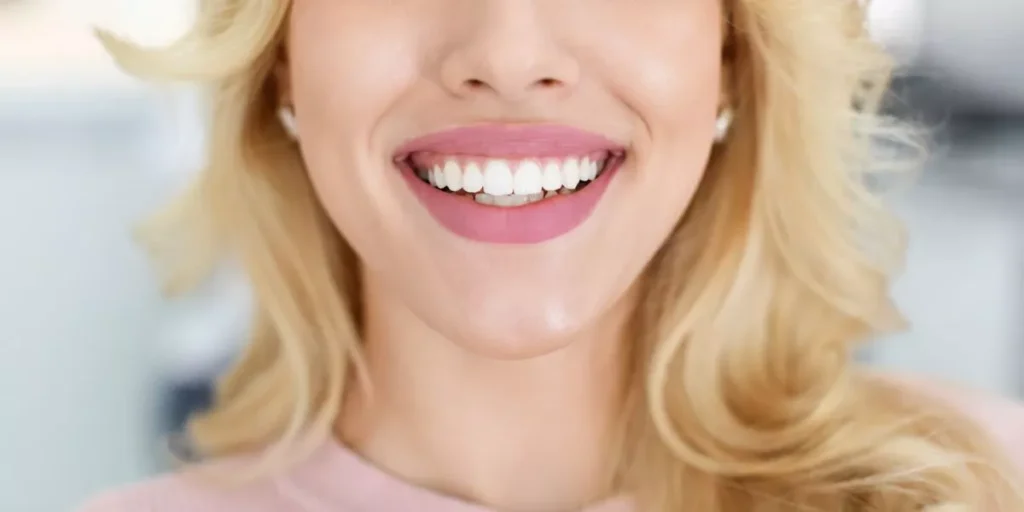 Snap-On Smile in Port Hueneme | Affordable Smile Makeover