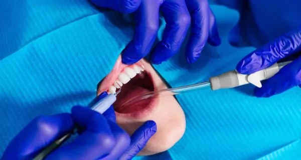What is a dental deep cleaning?