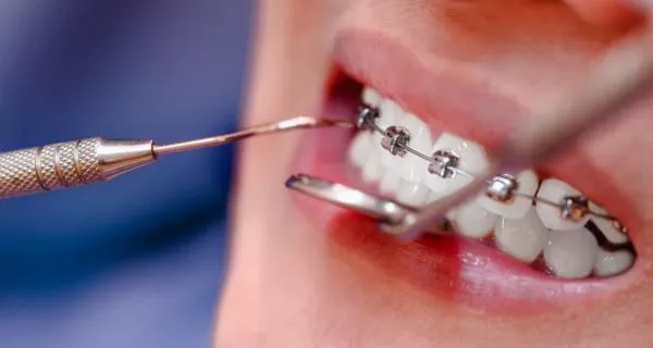 What is orthodontic treatment?