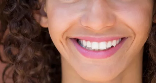 What is snap-on smile?