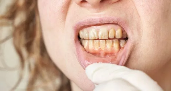 Who is a good candidate?