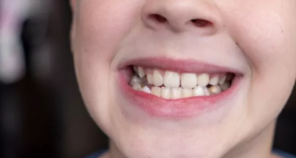 Who is orthodontic treatment for?