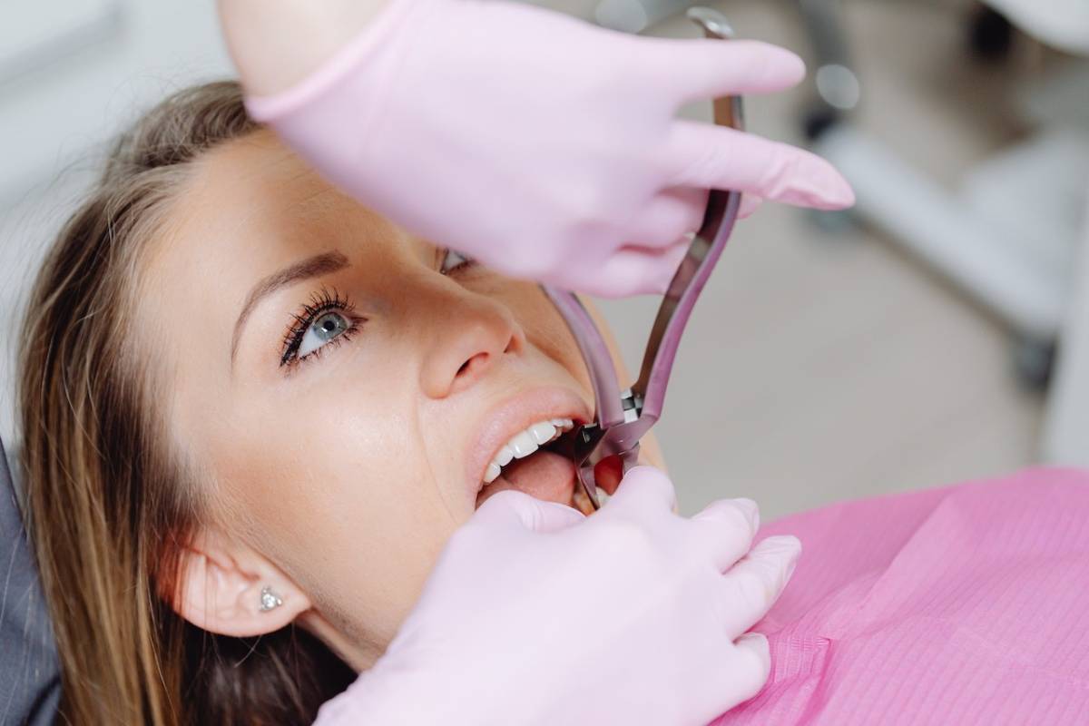 Tooth extraction