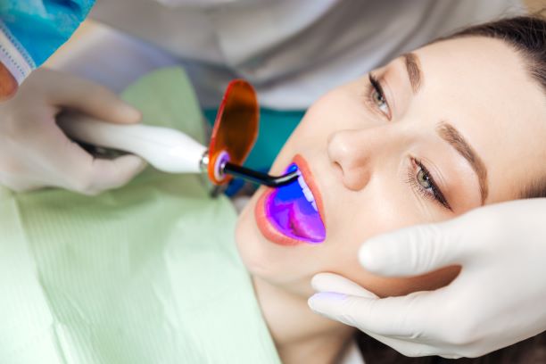Dental fillings