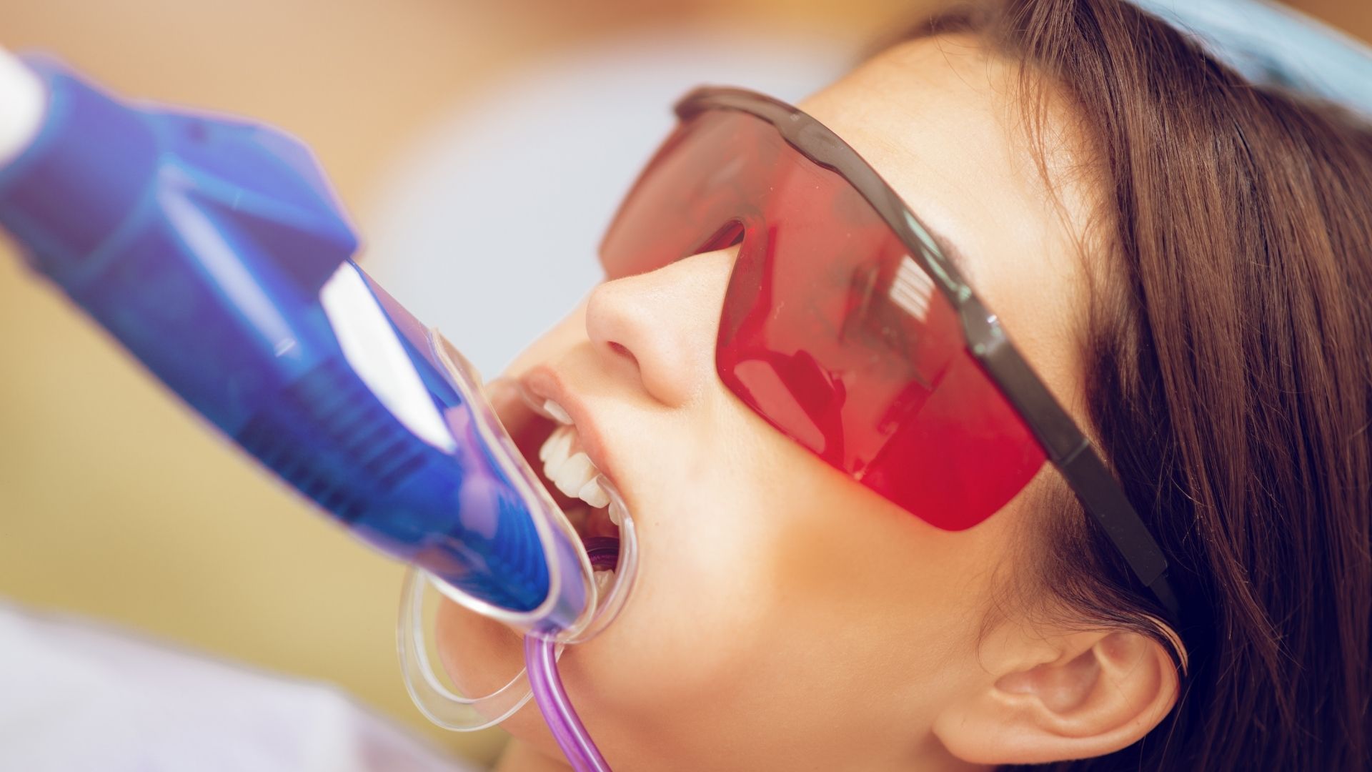 Teeth whitening